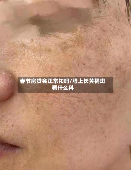 春节房贷会正常扣吗/脸上长黄褐斑看什么科-第1张图片